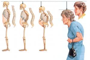 Методика занятий физическими упражнениями в пожилом и старшем возрасте Комплекс упражнений для всех